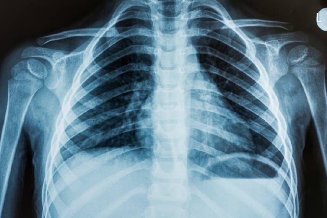 Do-Mobile-Medical-Vehicle-Have-X-Ray-Machines