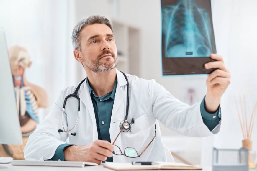 A focused physician or radiologist reviewing a chest X-ray in a clinical setting, demonstrating the diagnostic **benefits of mobile X-ray machines** for quick, on-site patient assessment and diagnosis.